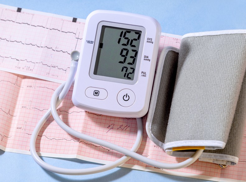 ecg-test